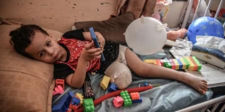غزة تسجّل أعلى معدل لبتر الأطراف لدى الأطفال نسبةً لعدد السكان عالمياً