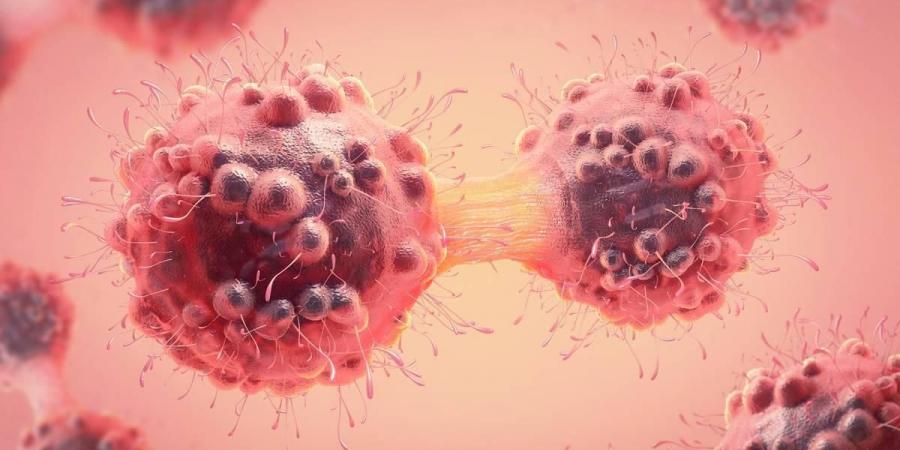 علاج يقضي على خلايا سرطانية في 30 دقيقة فقط