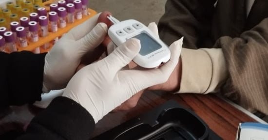 جامعة الزقازيق الأهلية: تغطية تأمينية كاملة للطلاب بنسبة 100% للكشف والأشعة